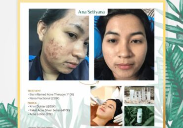 harga perawatan di larissa_51665aaff.jpg