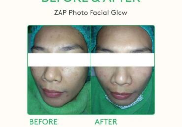 harga perawatan di medigreen clinic_04255170f.jpg