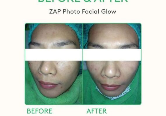 harga perawatan di medigreen clinic_04255170f.jpg