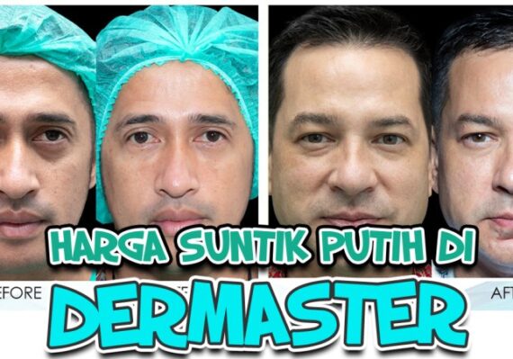 harga suntik kolagen_cbb505353.jpg