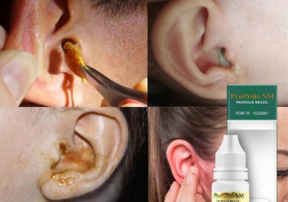 harga otopain di kimia farma_17197978f.jpg
